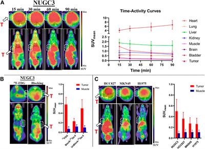 Synthesis, radiolabeling, and evaluation of 68Ga-labeled aminoquinoxaline derivative as a potent PFKFB3-targeted PET tracer